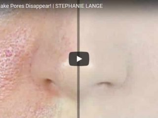 pores disappear