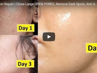 skin repair