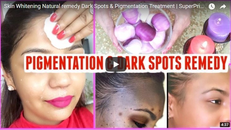dark spots and pigmentation treatment