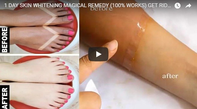 skin whitening magical remedy
