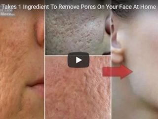 pores on your face